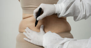 Modelagem corporal não invasiva